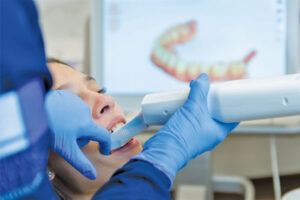 digital dental impressions